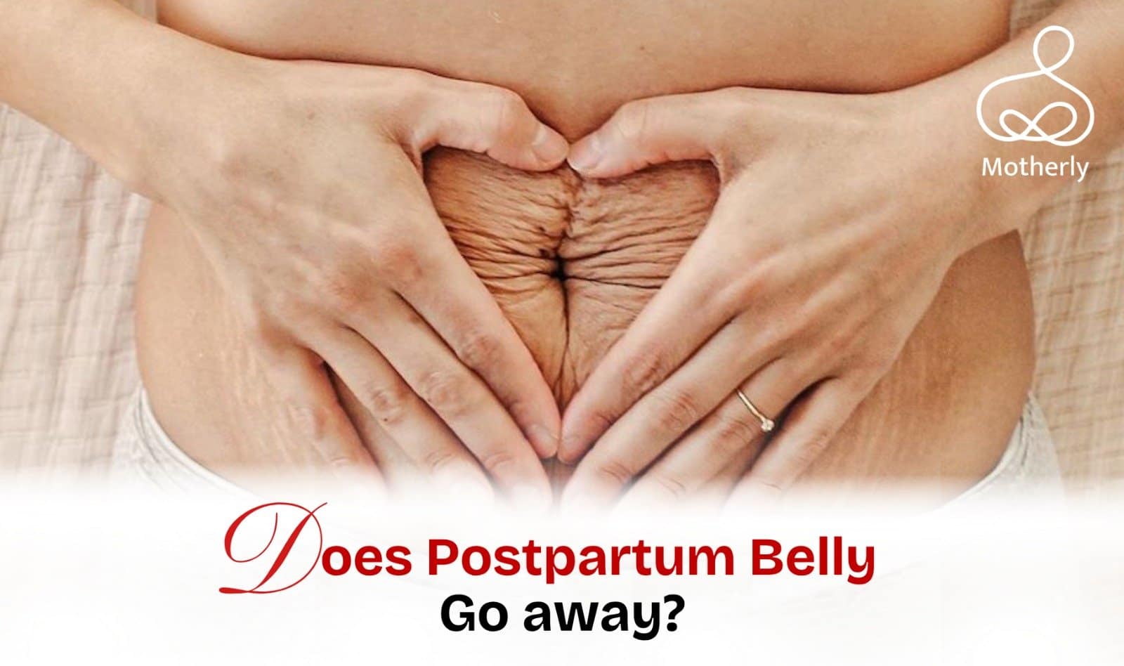 Does Postpartum Belly Go Away? A Realistic Recovery Guide for New Moms 4 DOES POSTPARTUM BELLY GO AWAY